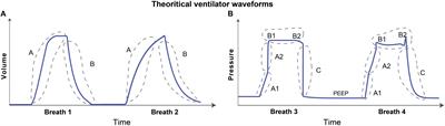 A Damaged-Informed Lung Ventilator Model for Ventilator Waveforms